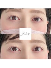 リリーストアネイル(Lily store nail)/まつげパーマ/ラッシュリフト