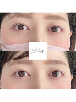 リリーストアネイル(Lily store nail)/まつげパーマ/ラッシュリフト