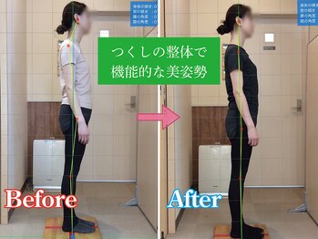 つくし鍼灸接骨院/20代/整体で機能的美姿勢