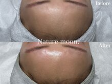 ナチュールムーン(Nature moon.)/ピーリング