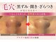 エステサロン カツキ(KATUKI)の写真/美肌WAX脱毛やプラズマ等で毛穴レスを実現♪化粧ノリ抜群の引き締まった発光ツヤ肌ケアで理想の自分へ◎
