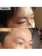 眉毛ハウス 吉祥寺店(眉毛HOUSE)/お客様の施術例(吉祥寺/東京)