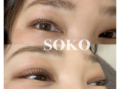 ソーコ(SOKO)の写真