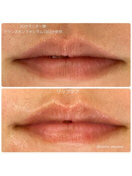 ラウレア(Laule'a)/パーツ リップケア