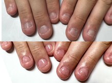 プレス ネイルアンドアイラッシュ(PRESS NAIL&EYELASH)の雰囲気（噛み爪、トラブルネイル、ハンドの巻き爪などお爪のお悩み解消！）