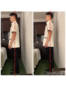 ビオプラス そごう横浜店(bioplus)/距骨調整ビフォーアフター