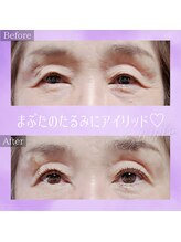 コトリ(kotori)/アイリッドアップパーマ