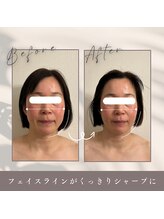 リル(LIL)/頭蓋調整＋小顔調整