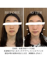 ヨサパーク リバティ 池袋東口店(YOSA PARK Liberty)/Before&After