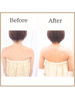サロンルーチェ(Salon Luce)/ビフォーアフター/施術回数5回