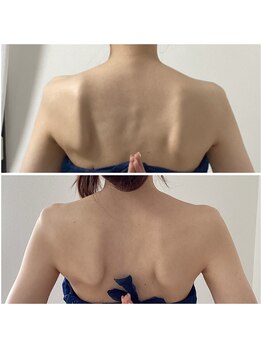 ポラス(Polus)/ブライダル肩甲骨ケア