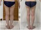 ゴーグ(gog)の写真/足の内側の筋肉を鍛えるマシンあて体験★美脚もヒップもアップで自信が持てる足元へ◎