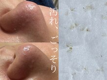 ケフィ(Kefi)の雰囲気（毛穴奥から汚れごっそり！結果重視の毛穴洗浄★）