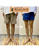 横浜DRT矯正院/O脚矯正