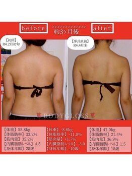 ボディグロス 梅田店(BODY GLOSS)/