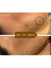 ラディアント 吉祥寺/お肌もフェイスラインもリフトUP