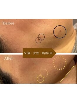 ラディアント 吉祥寺/お肌もフェイスラインもリフトUP