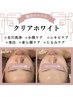 ★40周年限定★引きあがり抜群!!毛穴洗浄/美白/小顔矯正/たるみ改善/¥2980