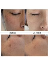 ピュア 川越店/サロンピュアスペシャルコース