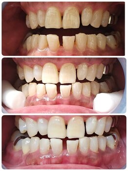 ハモットホワイト(Hamotto White)/照射3日目☆