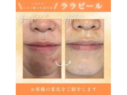 クリニカルホワイトケア 福岡店(クリニカルWHITEケア)の写真
