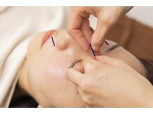 マッサージ鍼灸院つゆき按腹堂/美容鍼も！