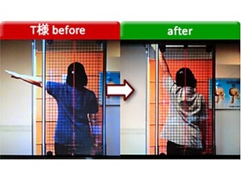 アセルカイロプラクティック/肩痛みケア　阿佐ヶ谷/カイロ