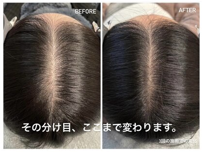 リードスラッシュ(LEAD/)の写真