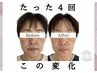 【再来クーポン】小顔矯正60分コース9,800円