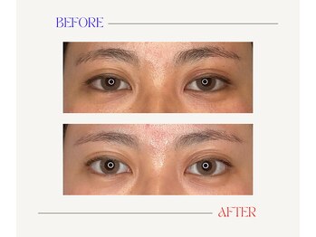 はりと美容鍼灸治療院(HaRi&美容鍼灸治療院)/