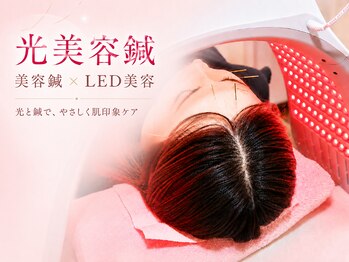 やわらぎ治療院の写真/鍼灸で健やかなお身体へ導く♪お悩みを丁寧な施術で改善へとサポートします！