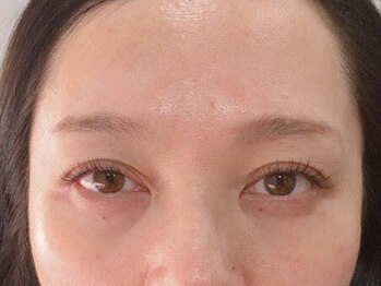 トミー(Tommy)/フラットラッシュ 100【50×50】