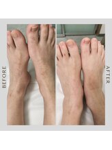 ケトリーナ/ブラジリアンワックス　ワックス