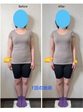 パルフェ(THE Parfait)/美容整骨【全身矯正】