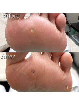 巻き爪補正店 町田店/