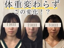 根本改善なので、症状の再発を防ぎます♪《草津/小顔矯正/整体》