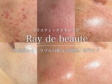 レイドボーテ(Ray de beaute)
