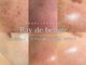 レイドボーテ(Ray de beaute)の写真