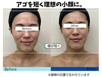 お顔の研究所/ビフォーアフター写真♪