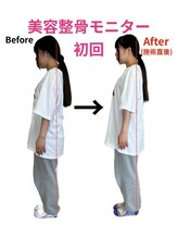 エムケーサロン(Mksalon)/全身美容整骨矯正モニター