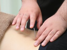 ほぐし屋百式 百式鍼灸院の雰囲気（業界１の細さの鍼を使用いたします。初めての鍼はぜひ当店へ！）