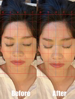 サロンドエルサ(Salon de ELSA)の写真/【男性整体師オールハンド施術】老化によって変形した骨格を整え若かりし頃の整った小顔へ◎