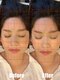 サロンドエルサ(Salon de ELSA)の写真/【男性整体師オールハンド施術】老化によって変形した骨格を整え若かりし頃の整った小顔へ◎
