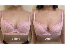 ハートランド(HEARTLAND)/プチクレオパトラ☆1回の施術