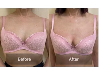 ハートランド(HEARTLAND)/プチクレオパトラ☆1回の施術