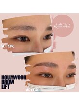 クィーンリッチ(Queen-Rich)/美眉【ハリウッドブロウリフト】