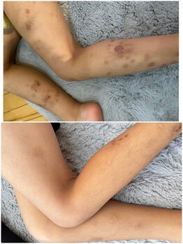 美顔研究所 バイ ヴィヴセカンド(美顔研究所 by viv 2nd)/