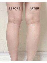 薬手名家 新宿店/小顔は顔だけではありません