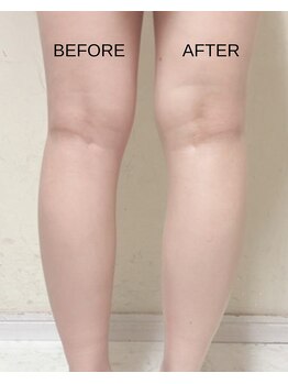 薬手名家 新宿店/小顔は顔だけではありません