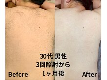 バディーズ(BUDDieS)/30代 男性 3回目から1ヶ後の状態